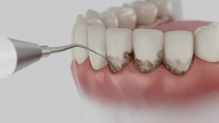 Reliable Dental Implants contractor in De Pere, WI by Smile Center Dentistry